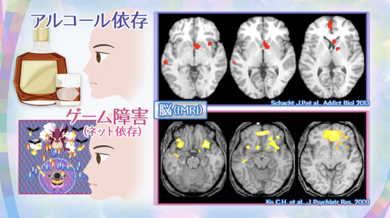 ゲーム依存の脳の状態